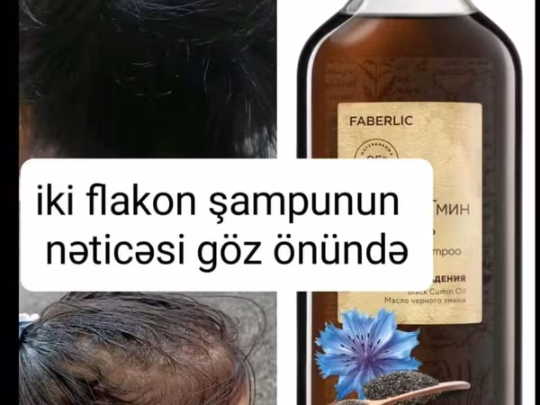 Kim istəsə sifariş edə bilər